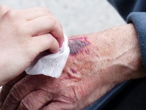 Erste Hilfe bei Aktivitäten im Freien – das müssen sie beachten 3 (c) Pixabay.com